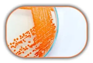 Enterobacteriaceae Sayımı