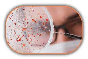 Koagülaz Pozitif Sitafilakokların Sayımı